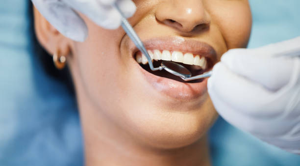 Best Emergency Dental Care for Abscessed Tooth in Ravenel, SC